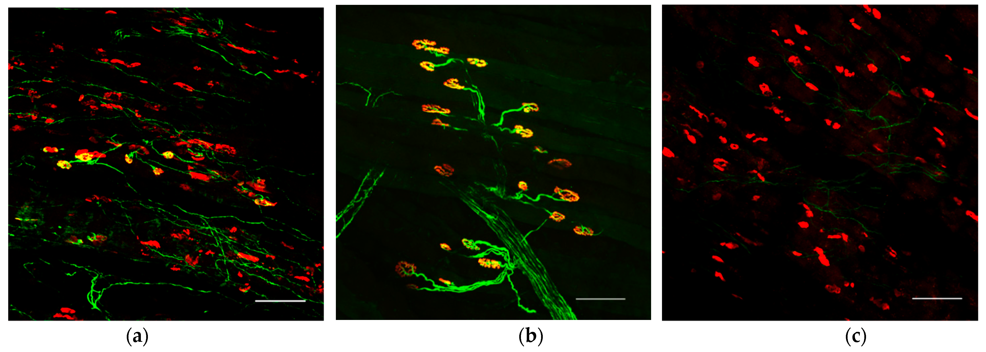 Ijms 23 08760 g004 550