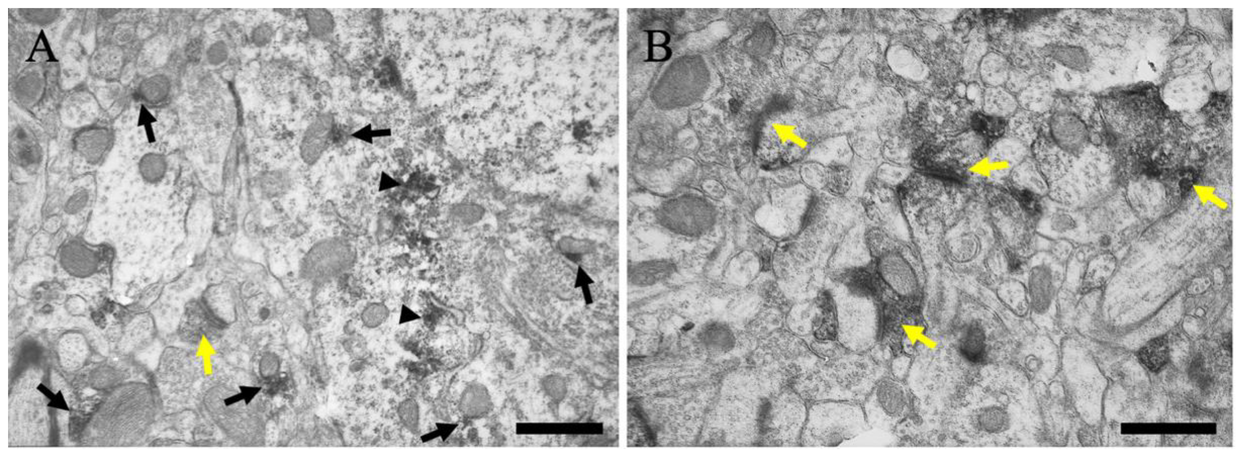 Ijms 23 08956 g005 Ijms 23 08956 g005