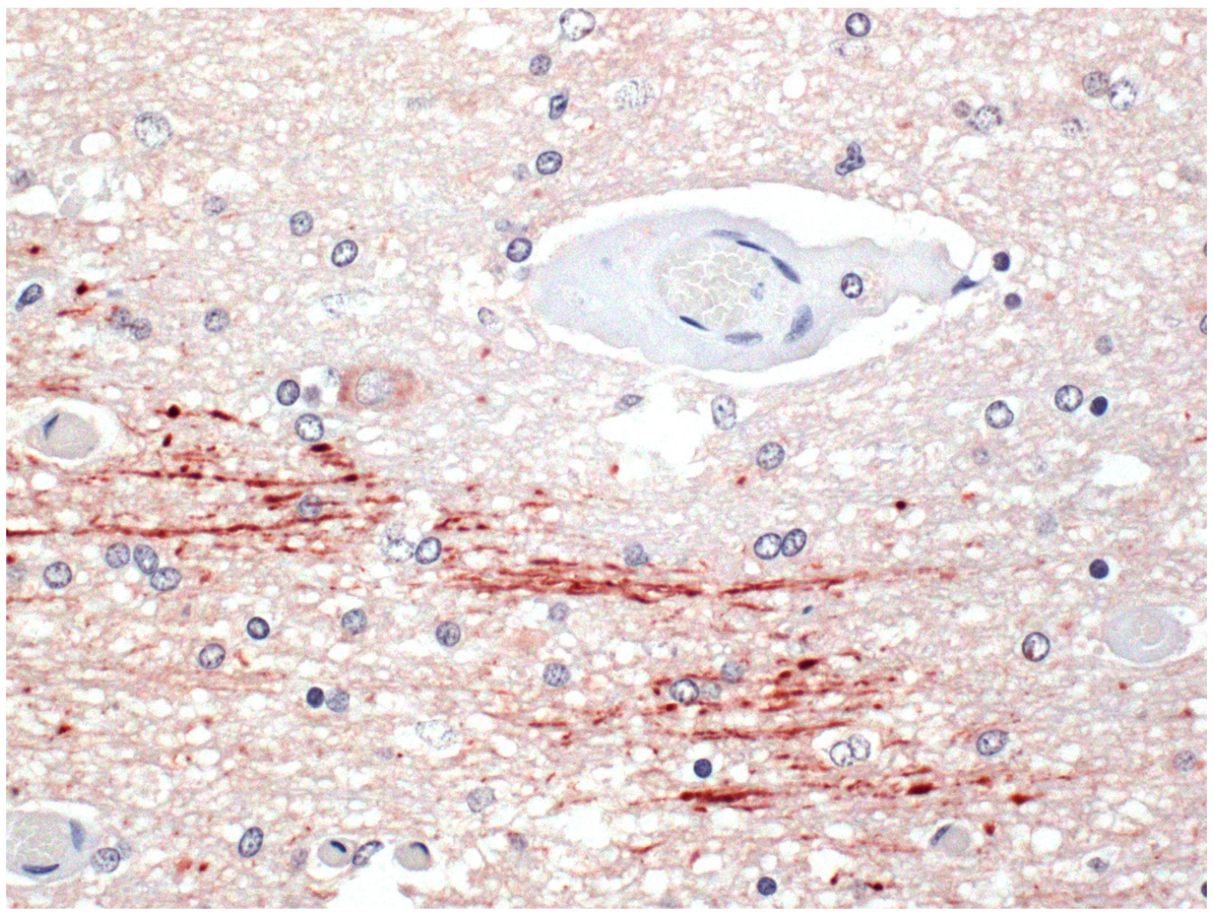 Ijms 23 09050 g006 550