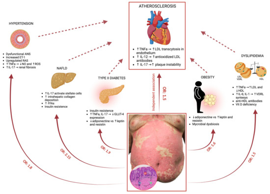 Psoriasis and Cardiometabolic Diseases: Shared Genetic and Molecular ...