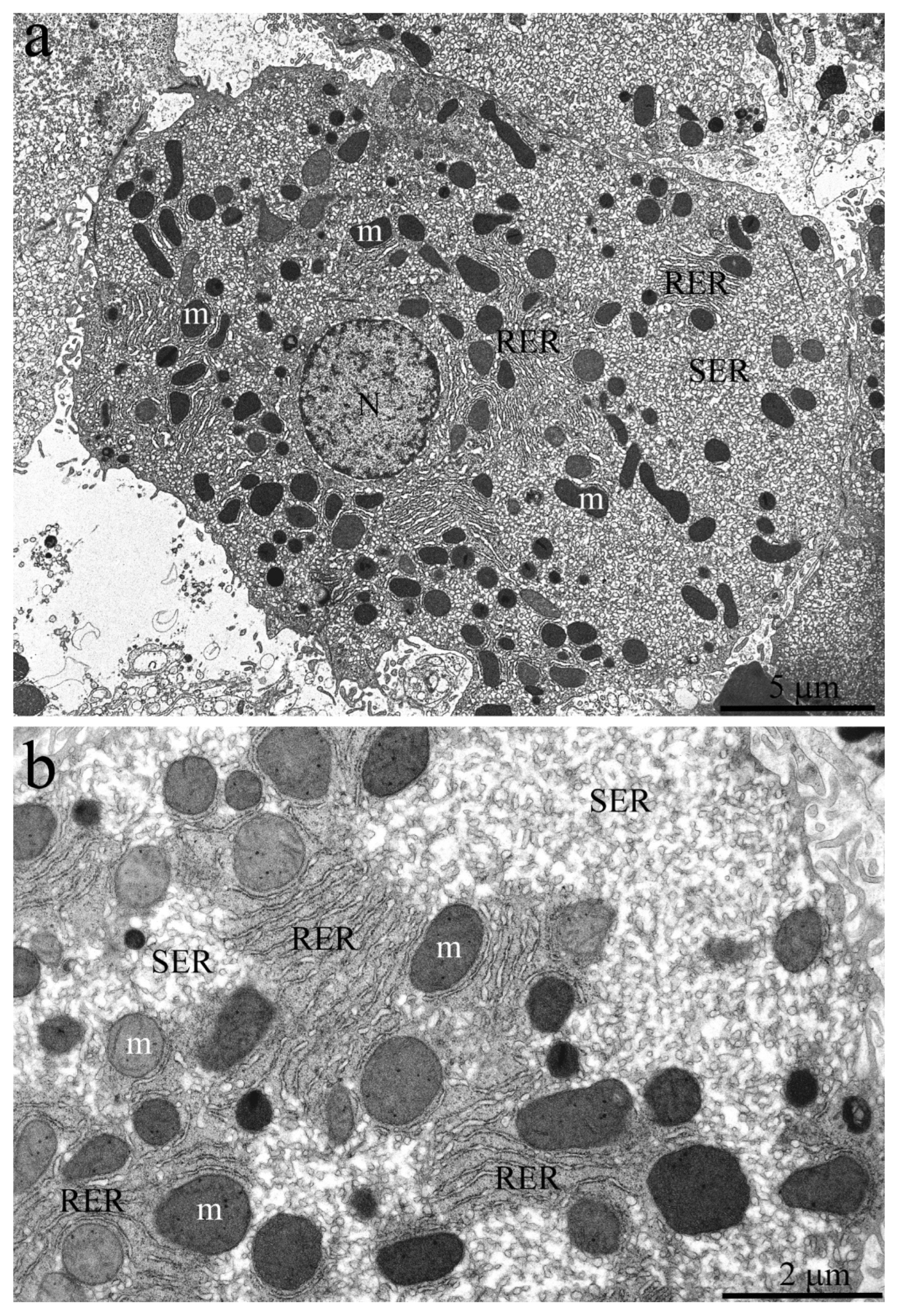 Ijms 23 09067 g004 550