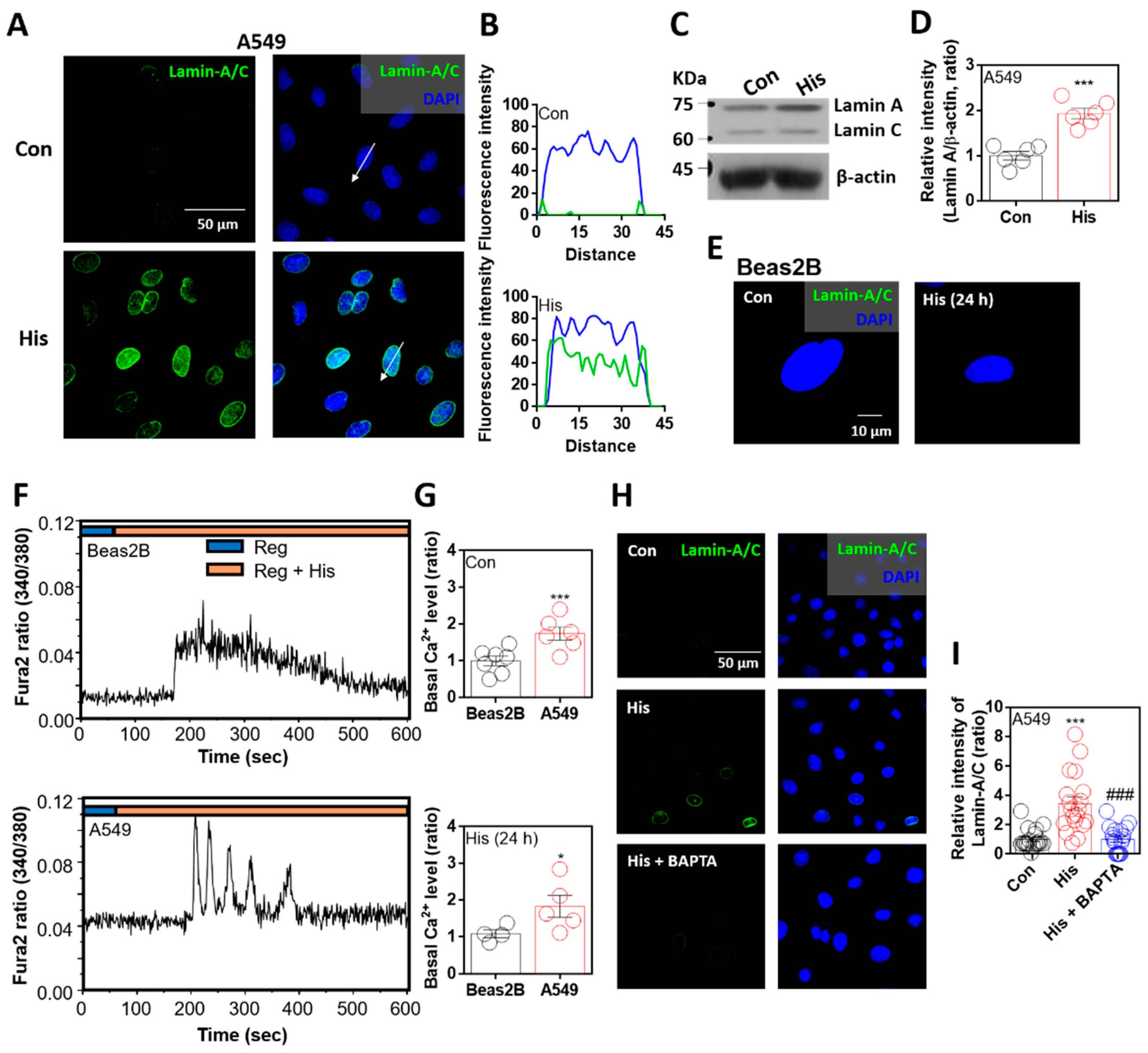 大人気新作 Lamin-A/C Is Modulated by the Involvement of Histamine トップス