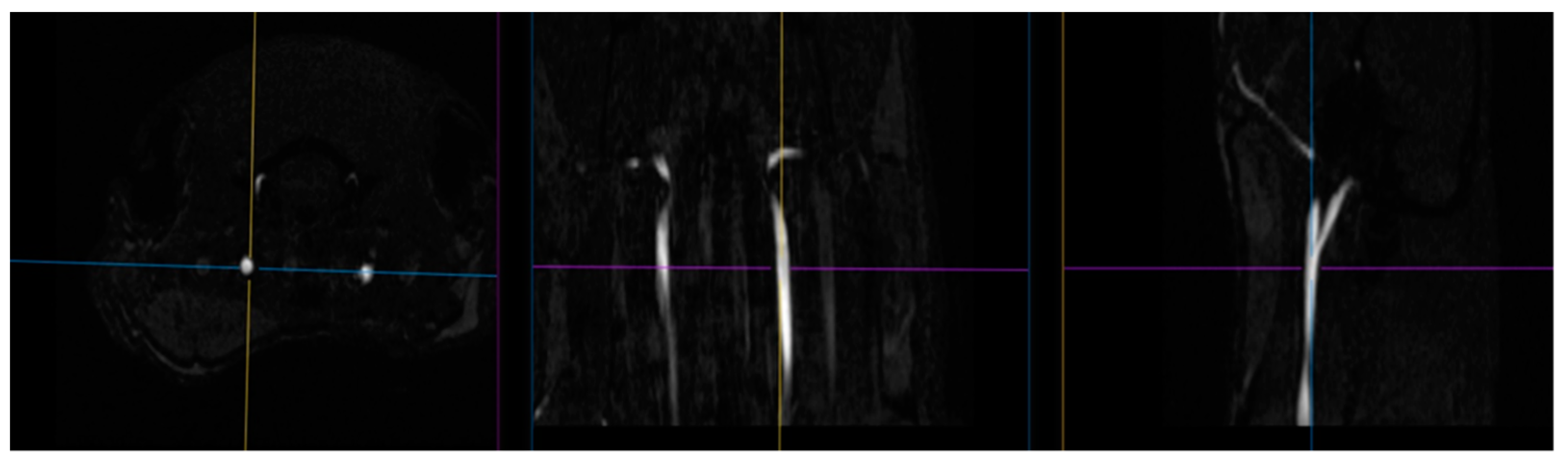 Ijms 23 09151 g014 550