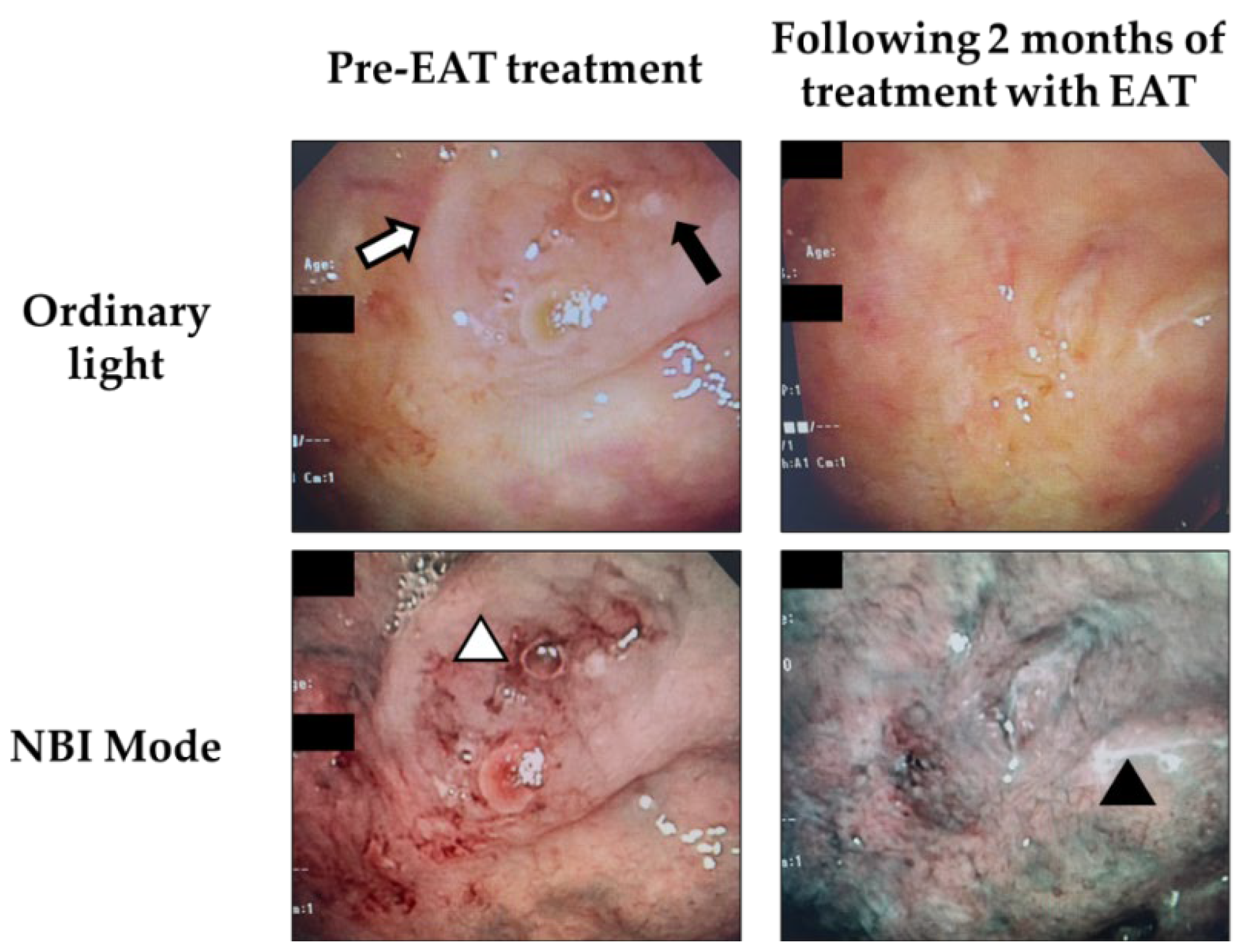 Ijms 23 09205 g001 550