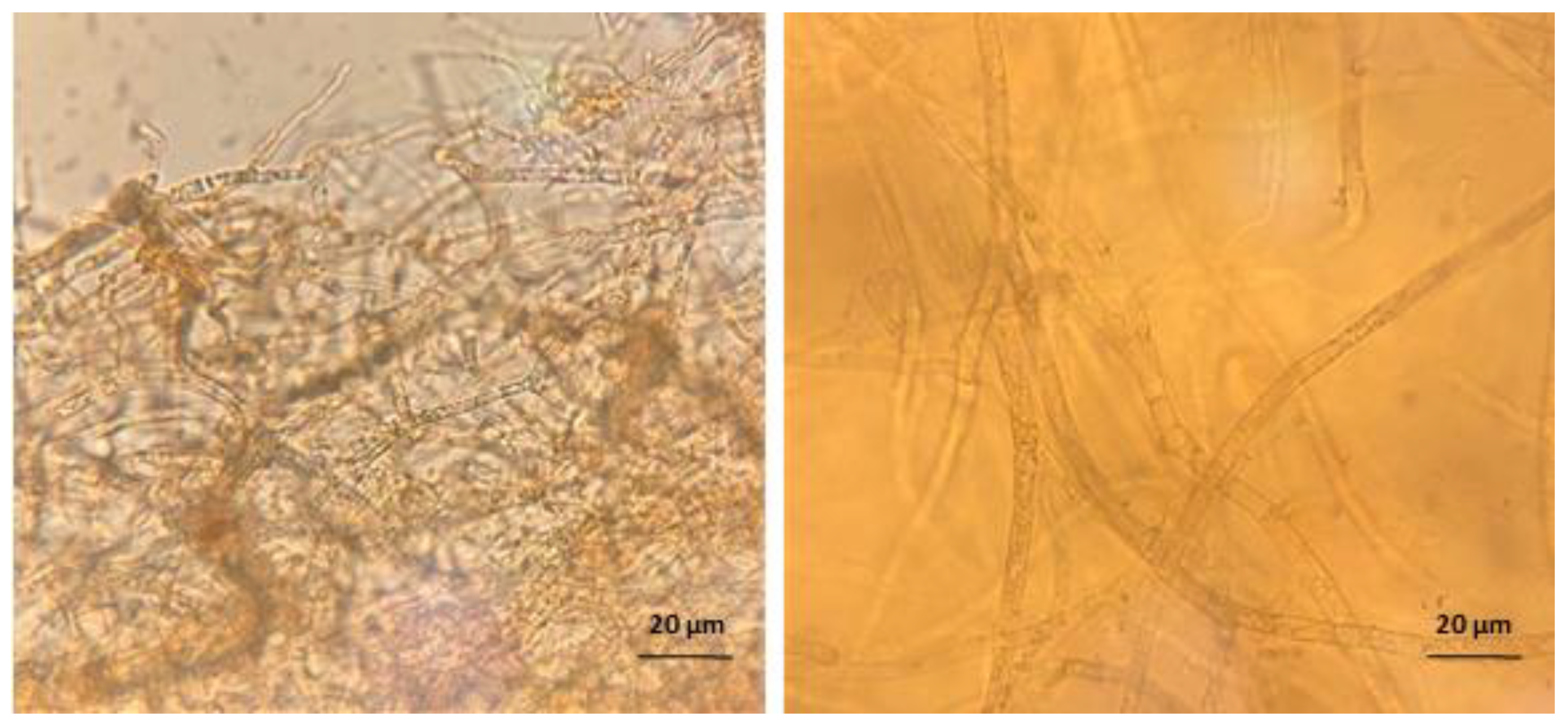 Ijms 23 09226 g006 Ijms 23 09226 g006