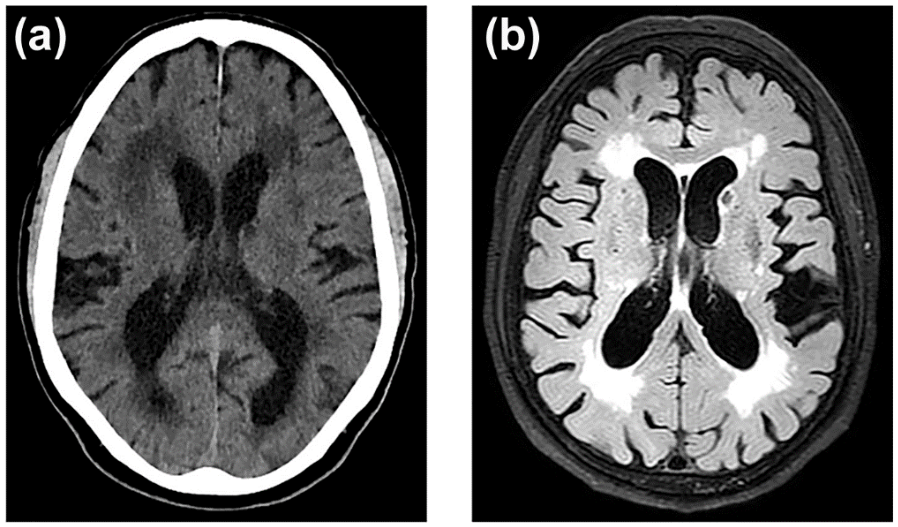 Ijms 23 09486 g003 Ijms 23 09486 g003