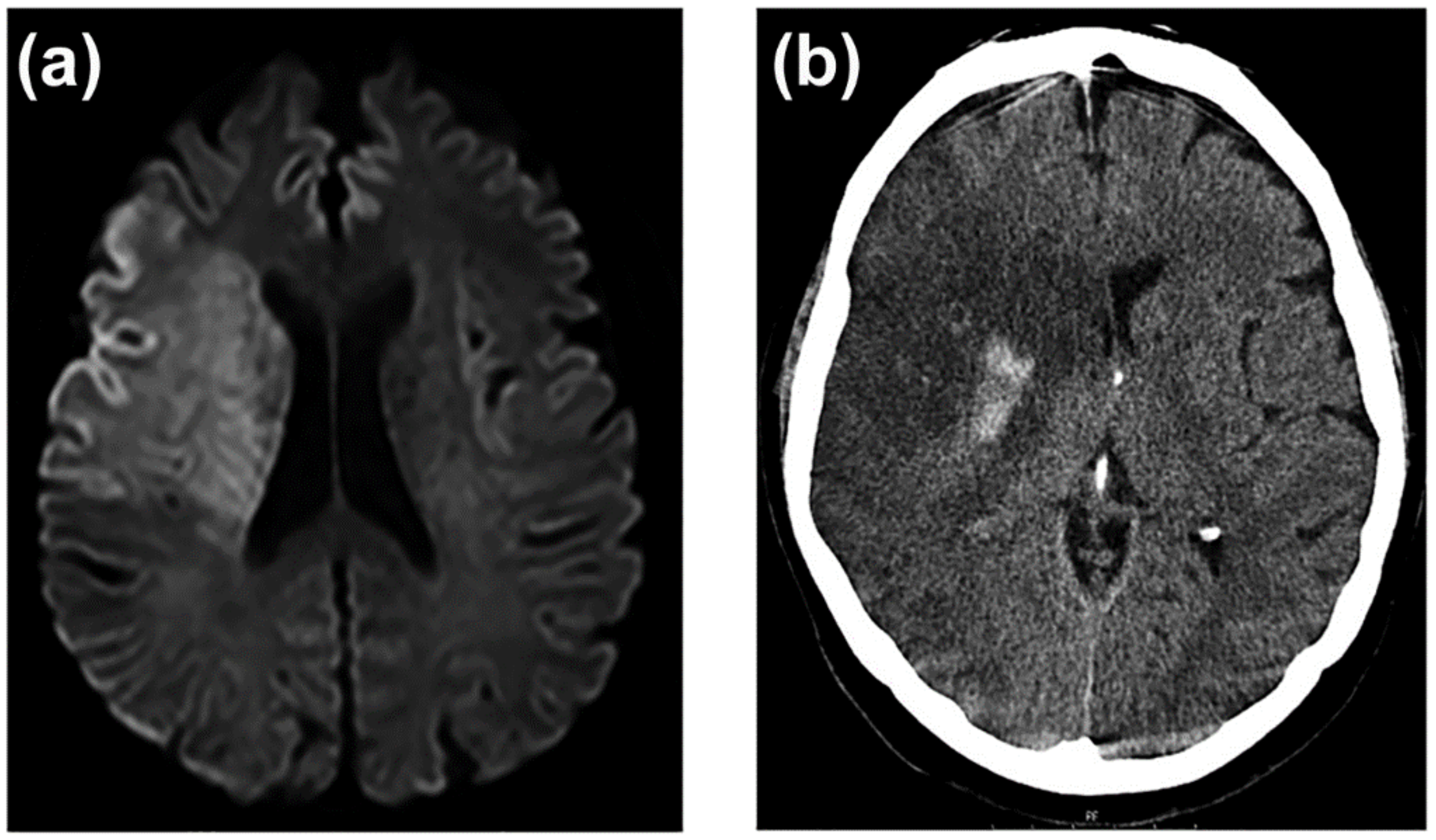 Ijms 23 09486 g004 Ijms 23 09486 g004