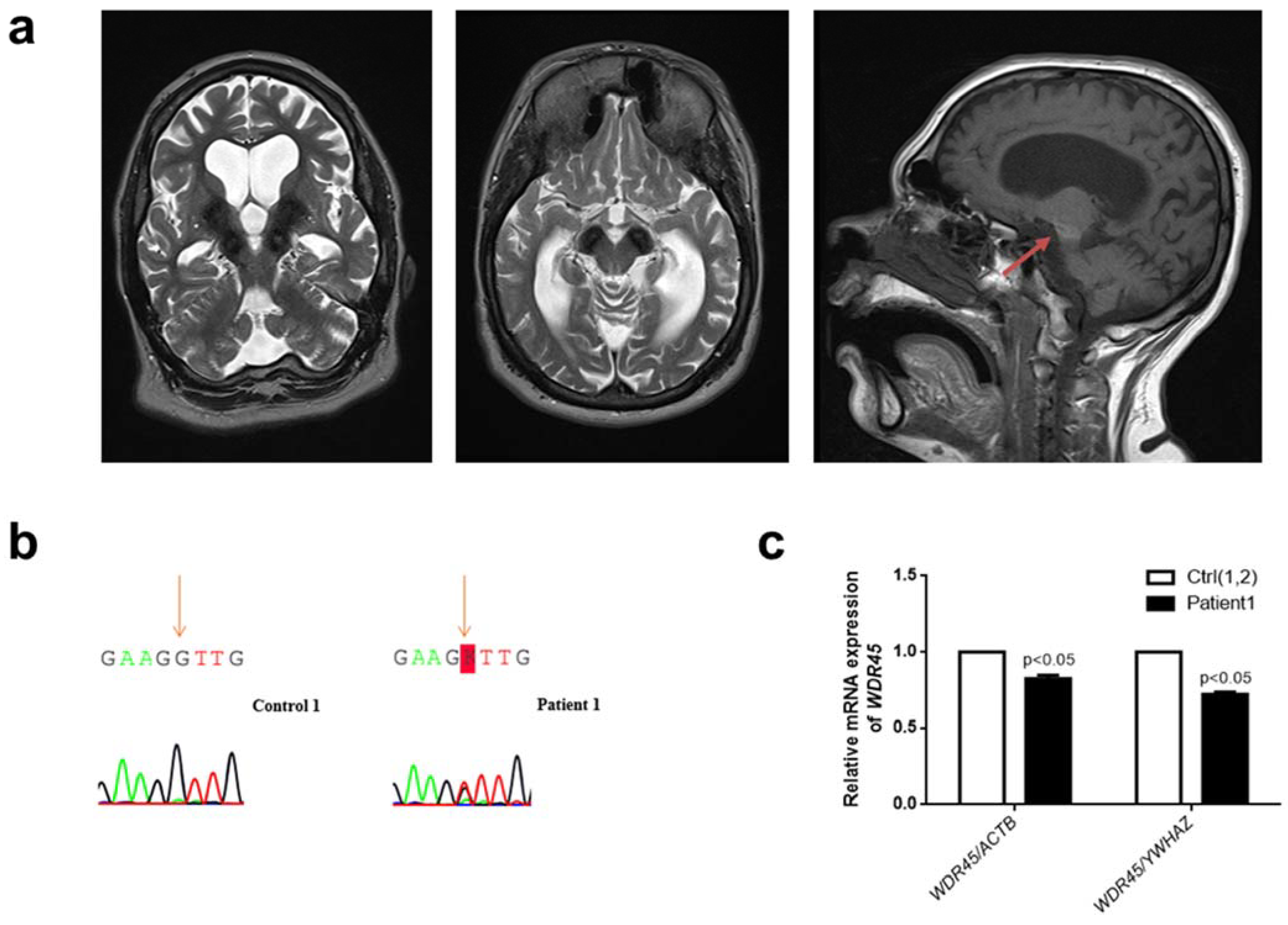 Ijms 23 09524 g001 550