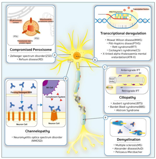 IJMS | Free Full-Text | Genetics behind Cerebral Disease with Ocular  Comorbidity: Finding Parallels between the Brain and Eye Molecular Pathology