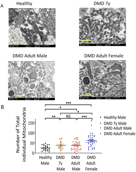 Bioenergetic and Metabolic Impairments in Induced Pluripotent Stem Cell ...