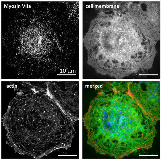 Tuning of Liver Sieve: The Interplay between Actin and Myosin ...