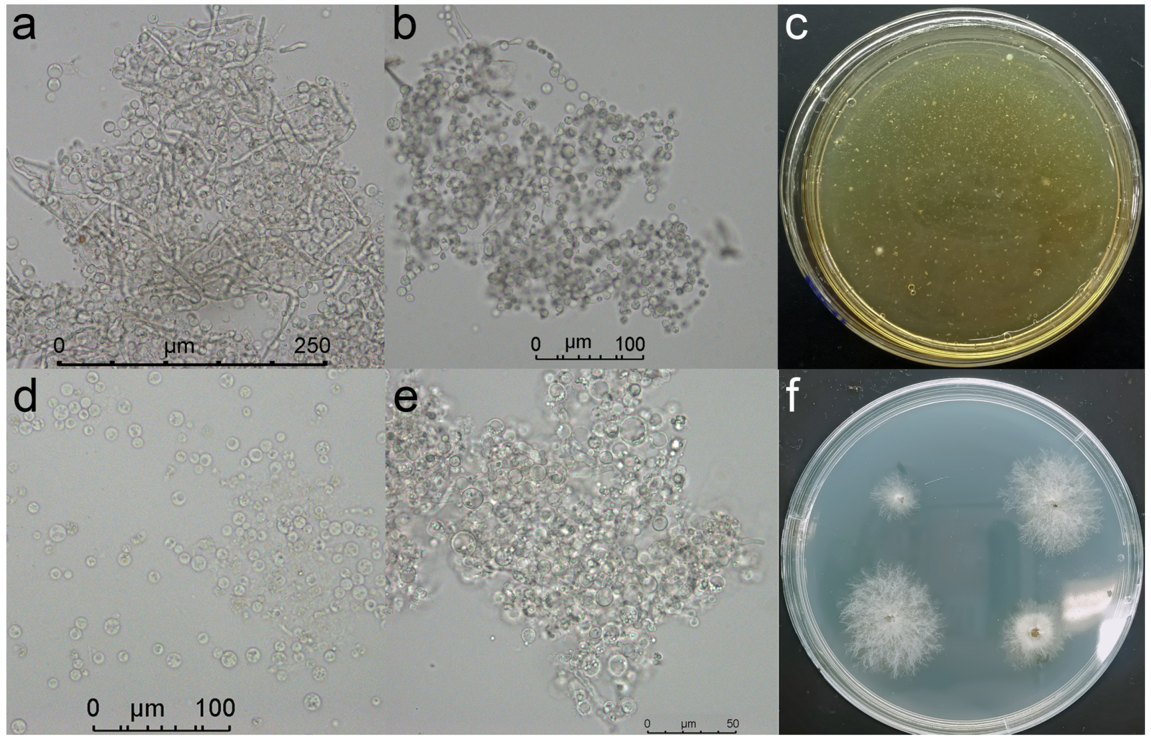 Ijms 23 09908 g011 550