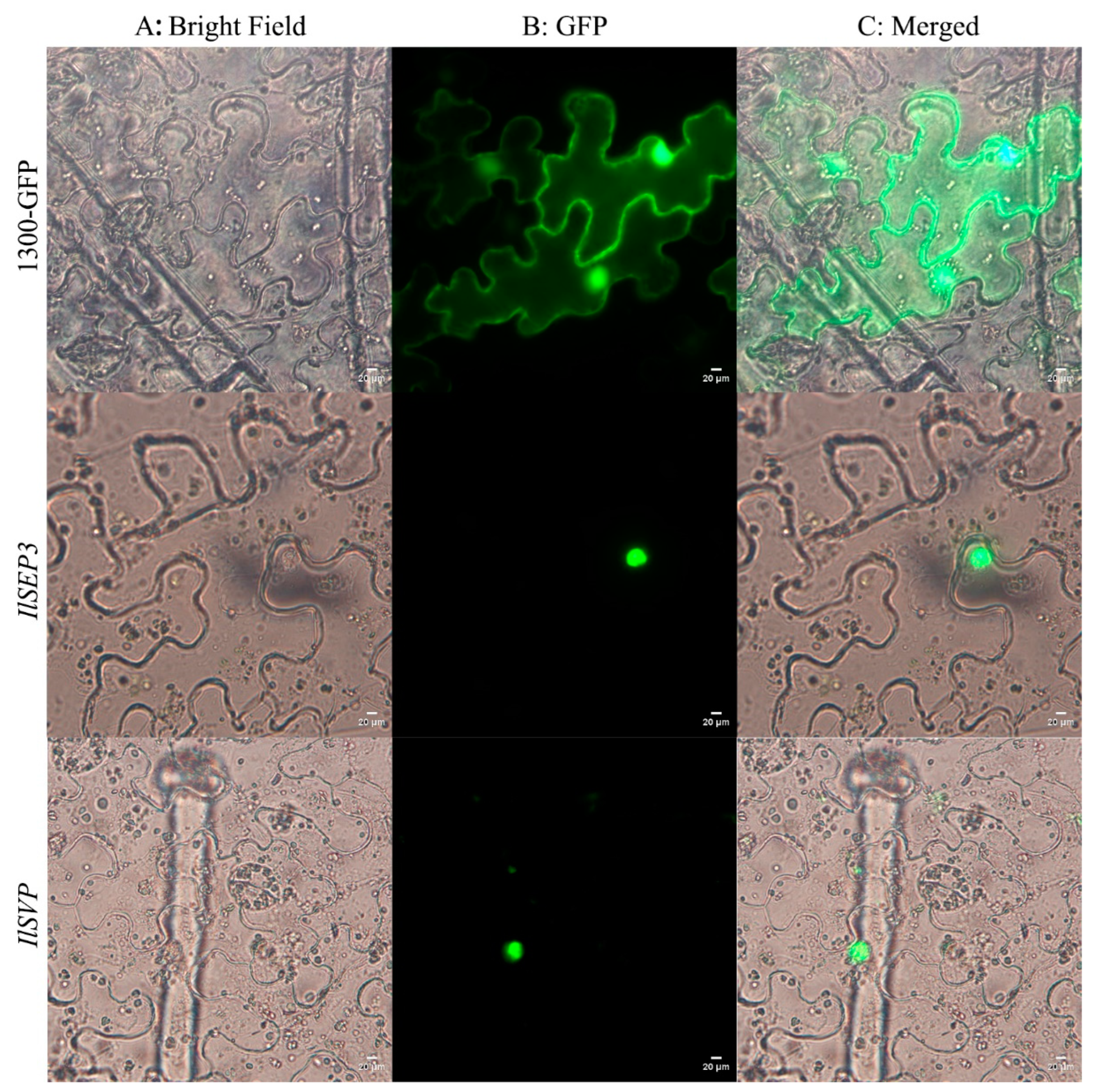 Ijms 23 09950 g004 550