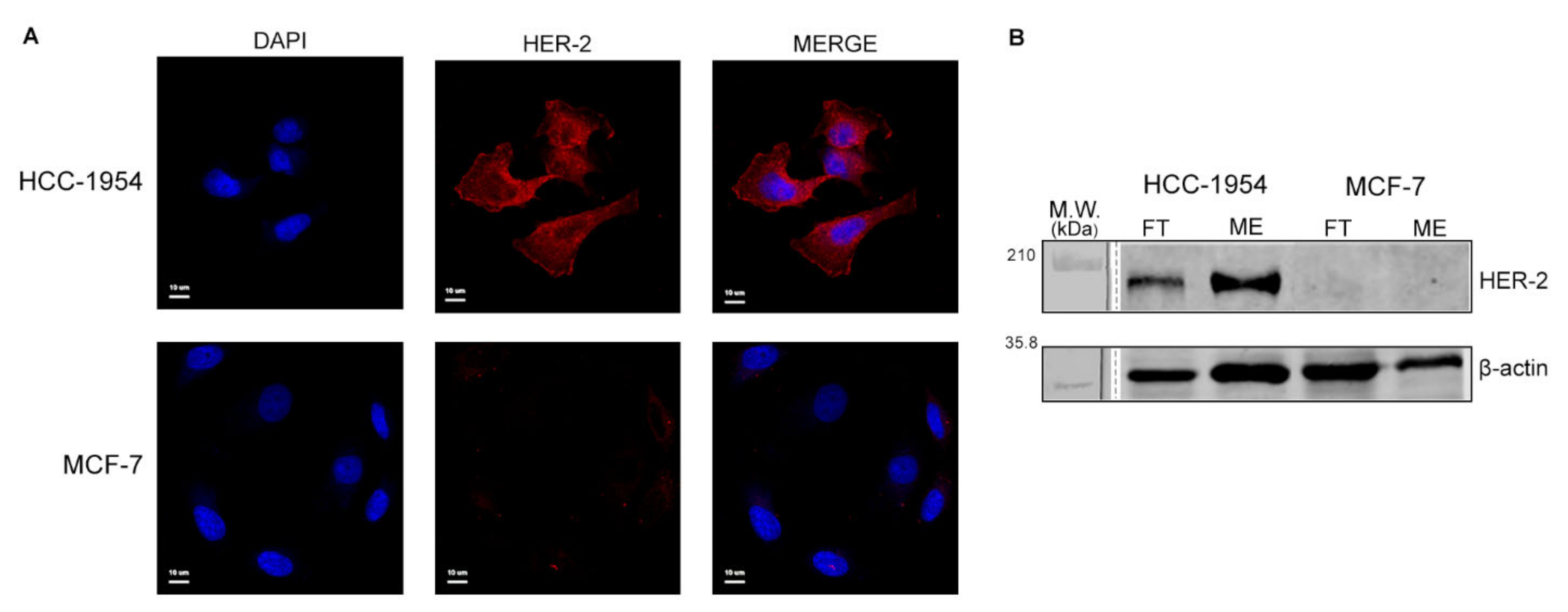 IJMS Free FullText Proteomic Analysis of HCC1954 and MCF7 Cell