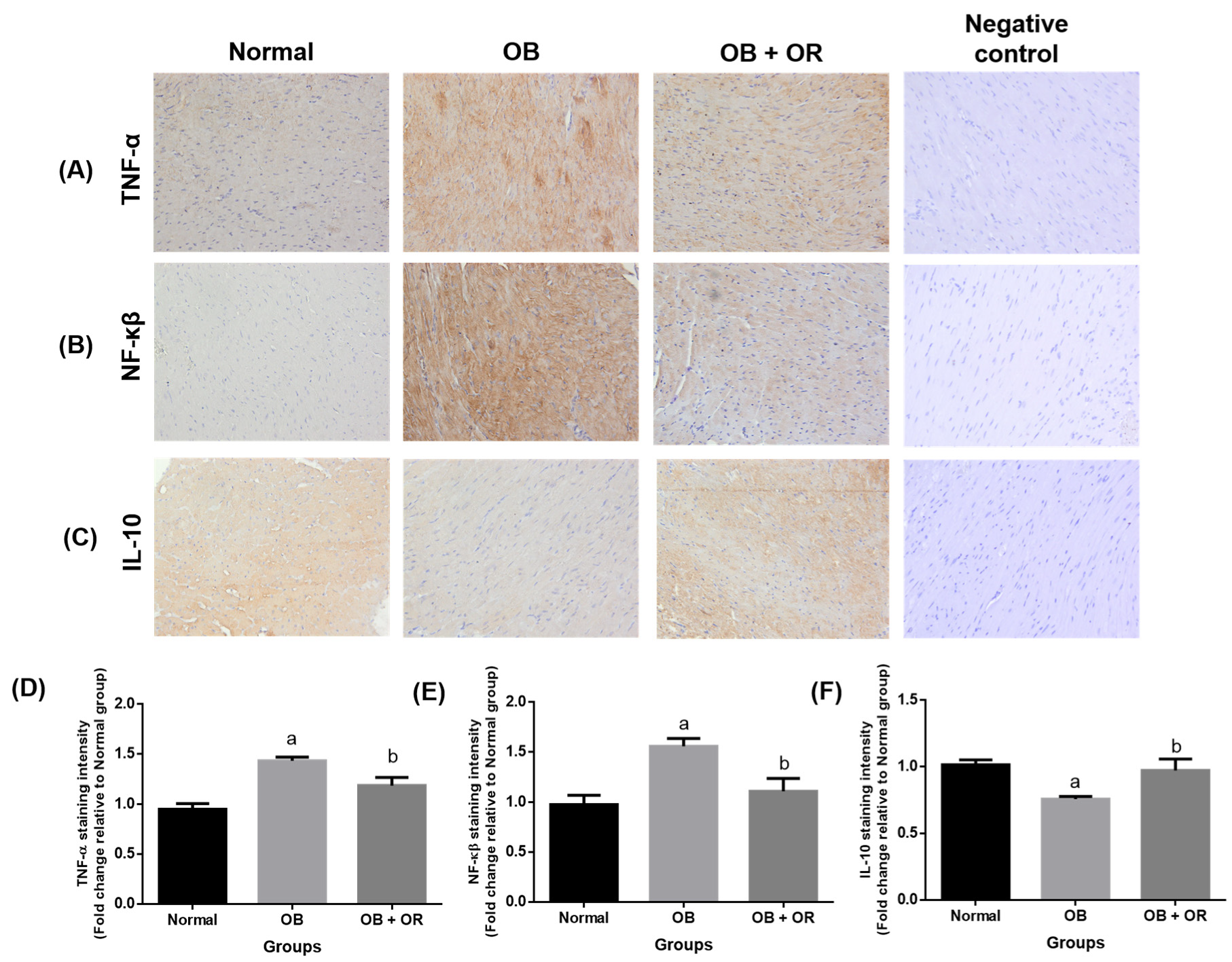 Ijms 23 10266 g003 550