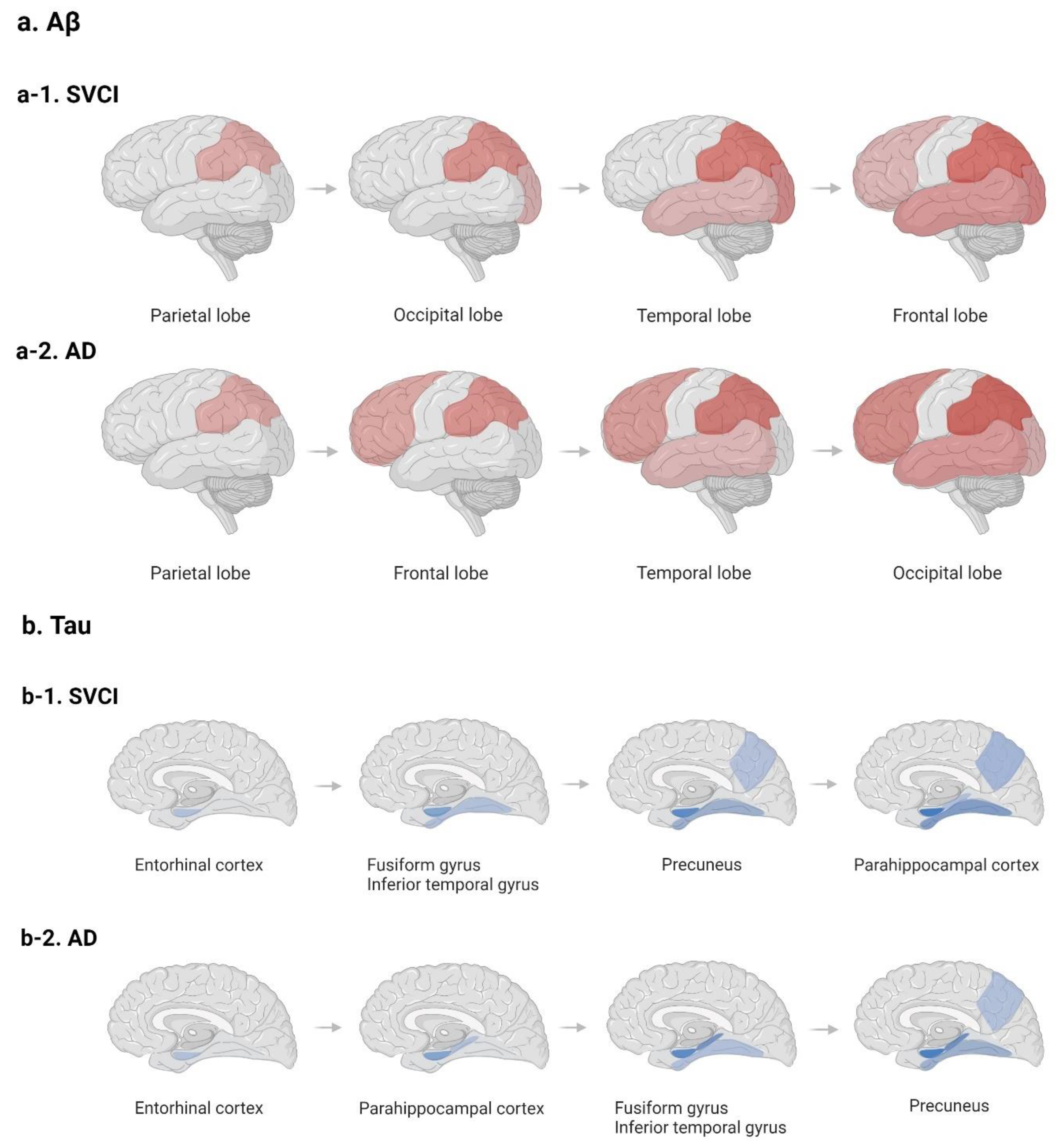 Frontiers  Fully Automatic Classification of Brain Atrophy on NCCT Images  in Cerebral Small Vessel Disease: A Pilot Study Using Deep Learning Models