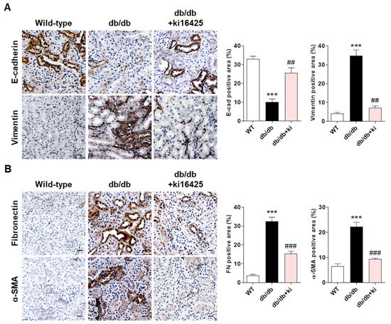 Lysophosphatidic Acid Promotes Epithelial–Mesenchymal