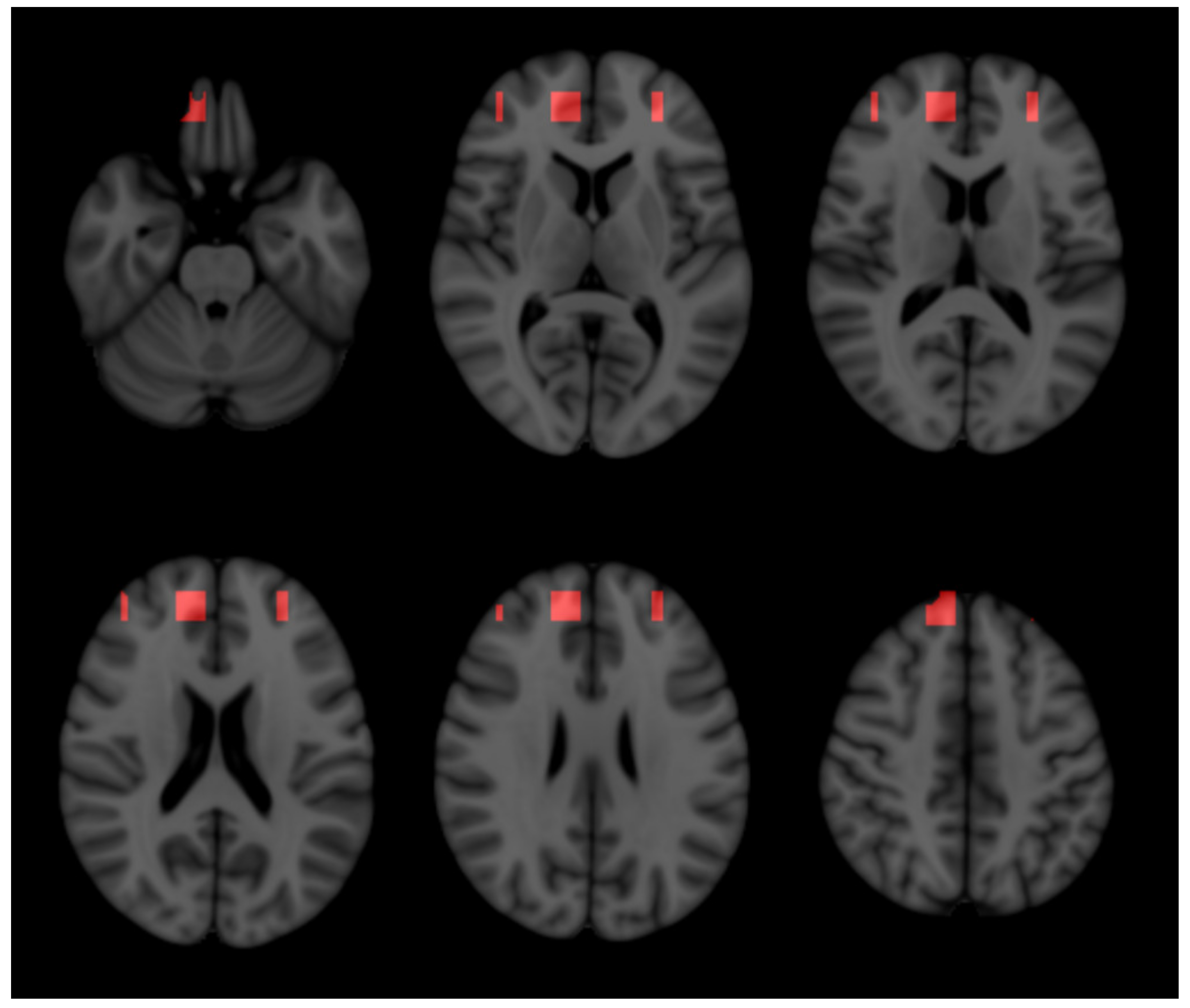 Ijms 23 10651 g003 550