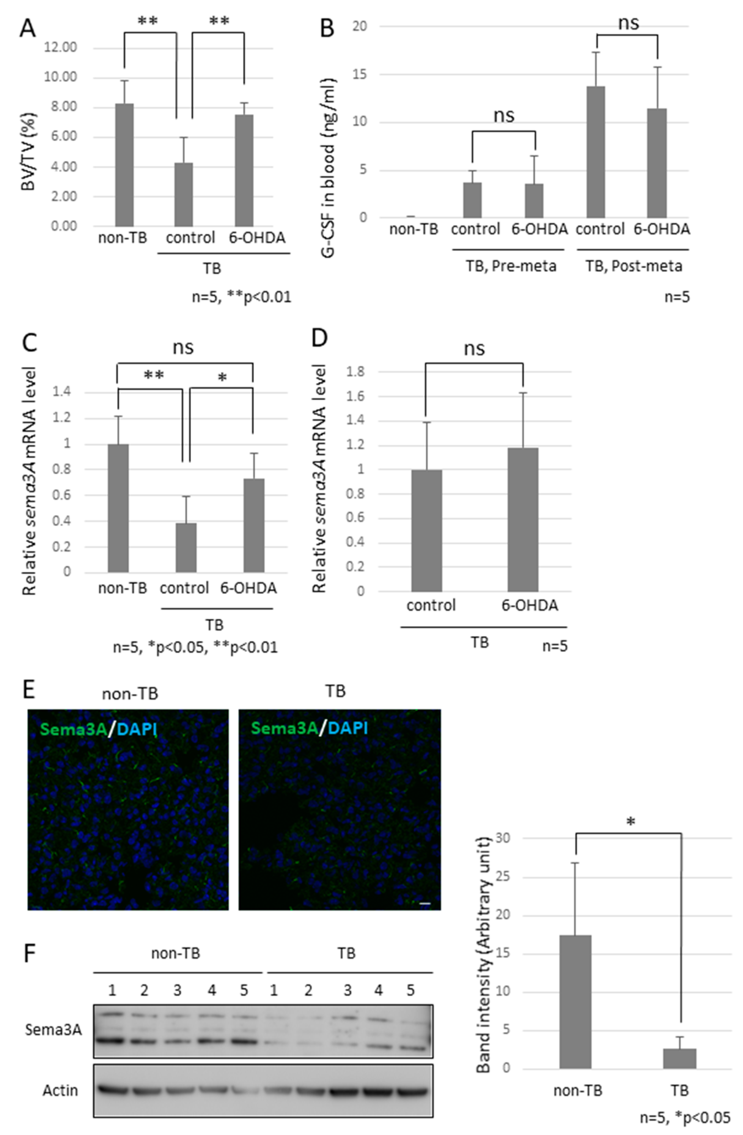 Ijms 23 10652 g004a 550