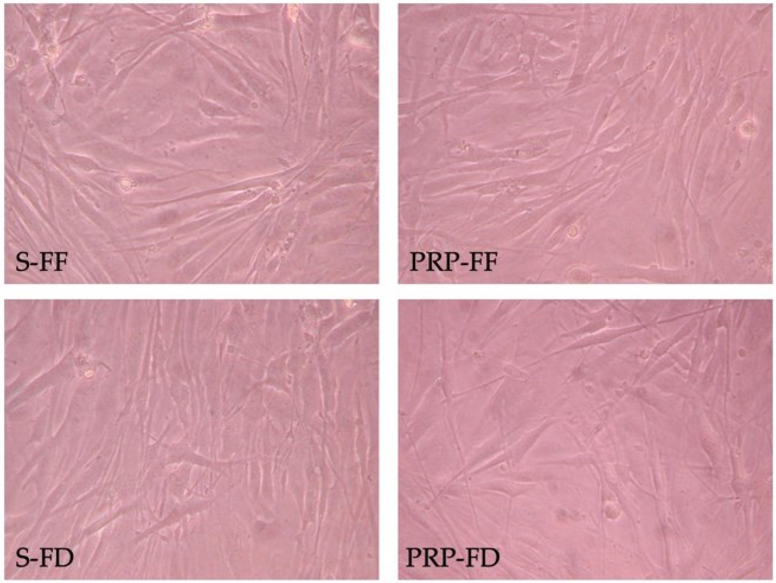 Ijms 23 10701 g002 550