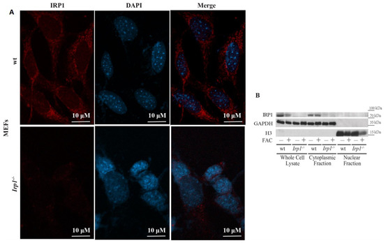 Human IRP1 Translocates to the Nucleus in a Cell-Specific and Iron ...