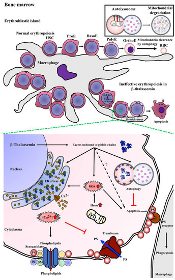 The Roles of Mitophagy and Autophagy in Ineffective Erythropoiesis in β ...