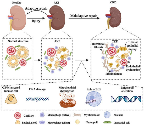 From AKI to CKD: Maladaptive Repair and the Underlying