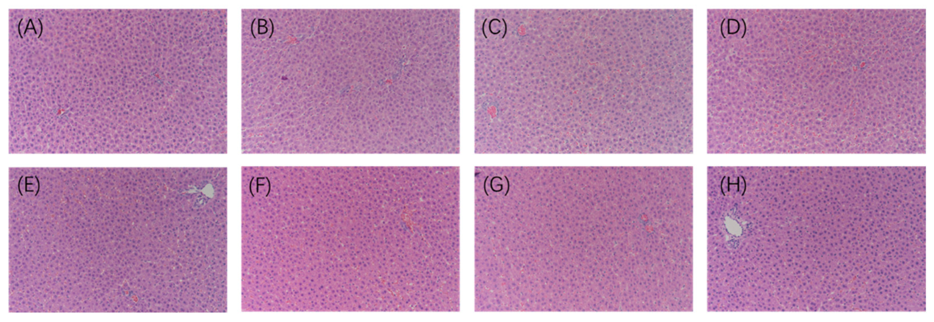 The Protective Effect of Lycium barbarum Betaine and Effervescent Tablet  Against Carbon Tetrachloride-Induced Acute Liver Injury in Rats - Yuqing  Zhai, Huaqiang Tang, Qunhui Zhang, Yanfeng Peng, Linlin Zhao, Benyin Zhang,  Yongjing