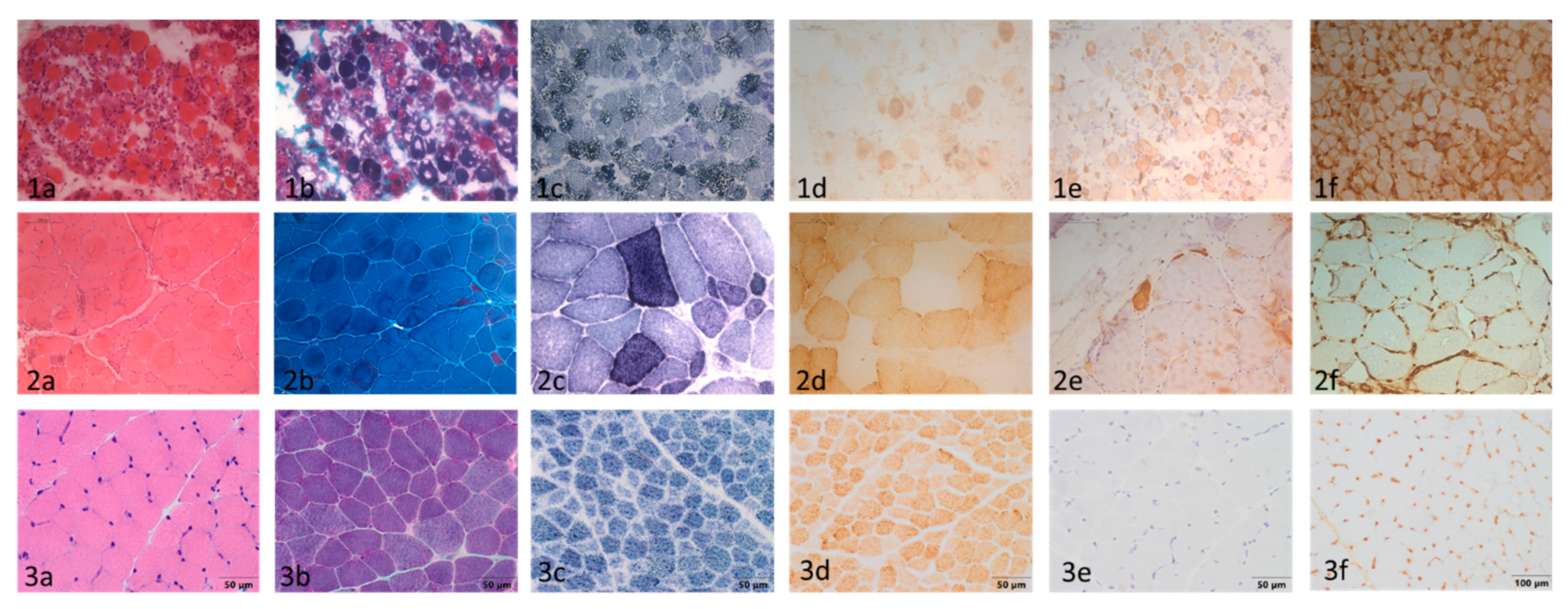 Ijms 23 11002 g001 550