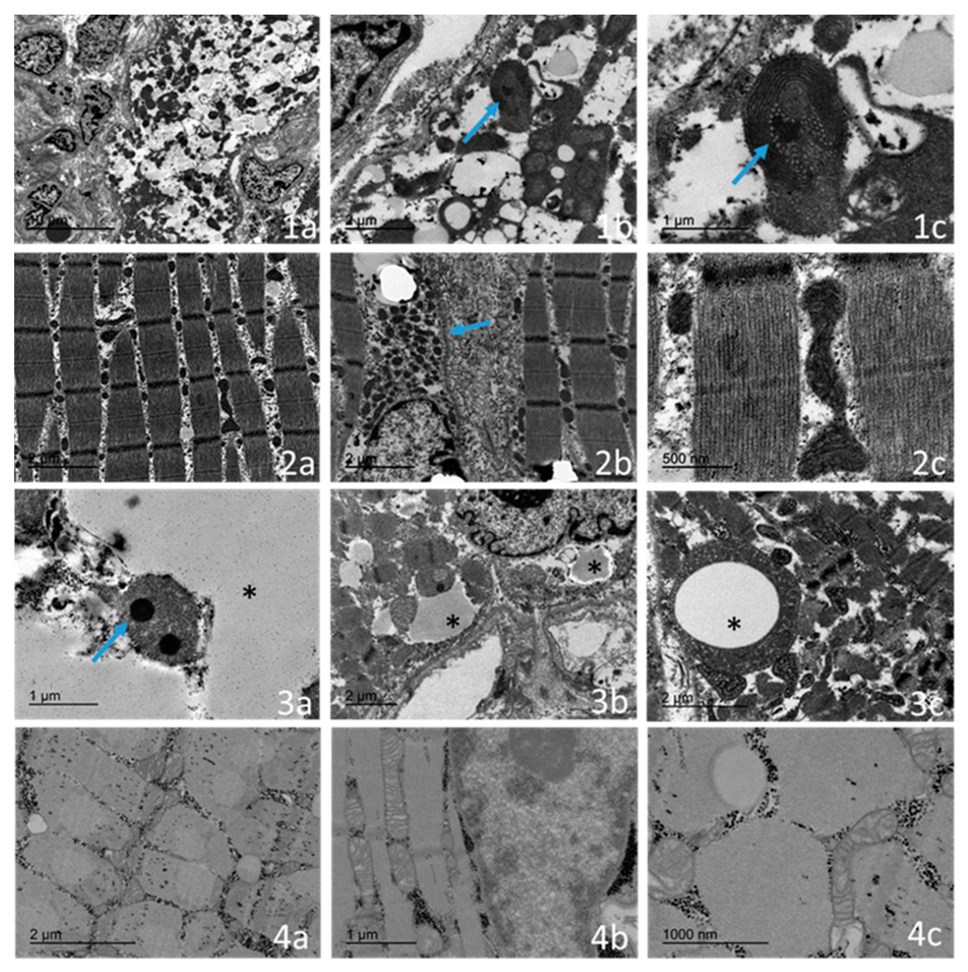 Ijms 23 11002 g004 550