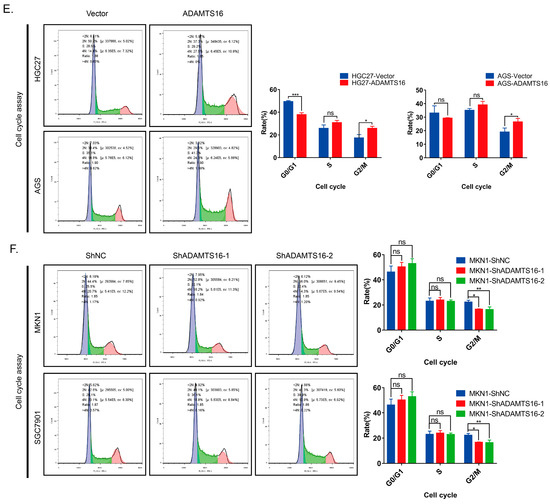 The Novel Protein ADAMTS16 Promotes Gastric Carcinogenesis The Novel Protein ADAMTS16 Promotes Gastric Carcinogenesis