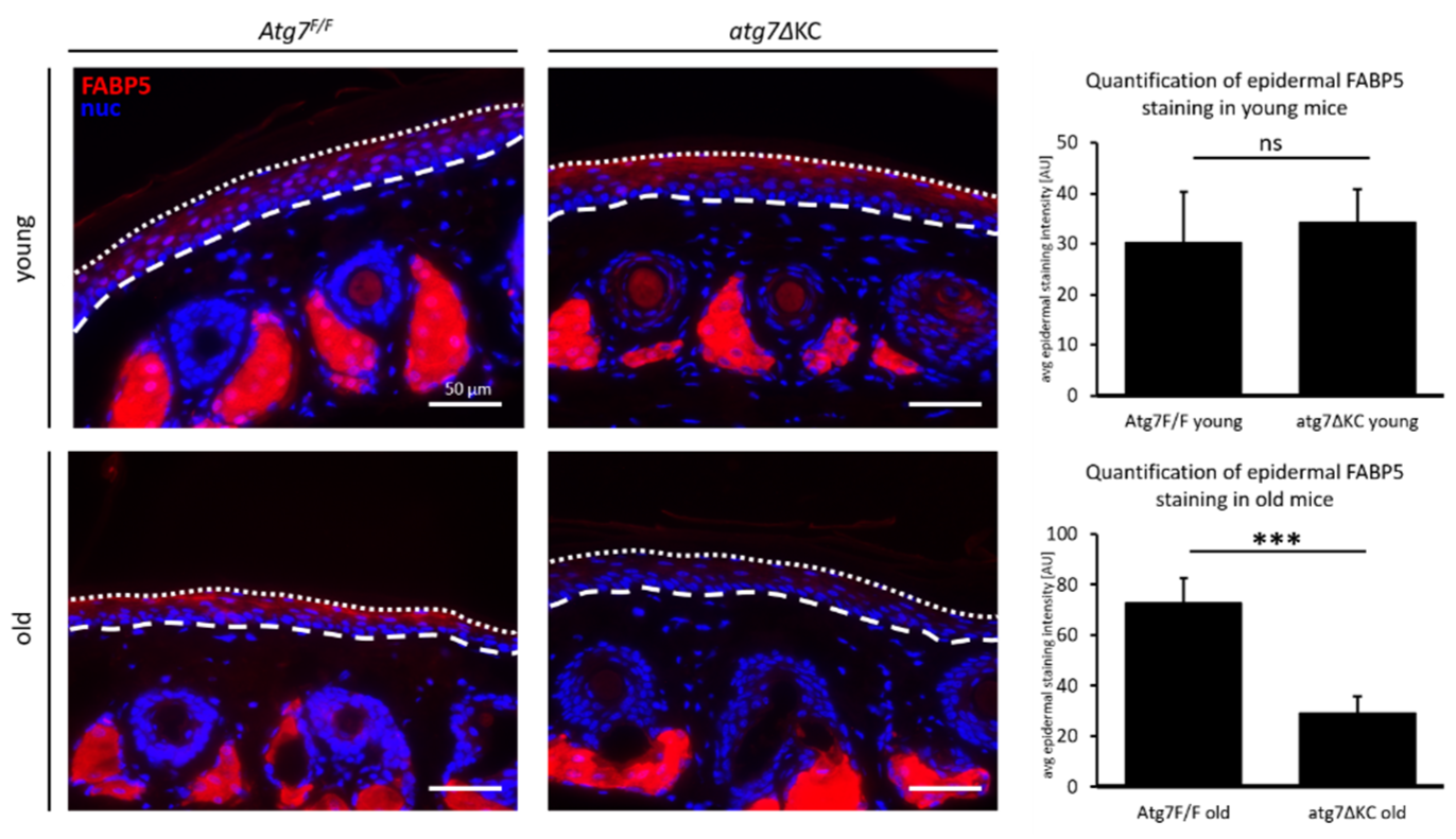 Ijms 23 11110 g004 Ijms 23 11110 g004