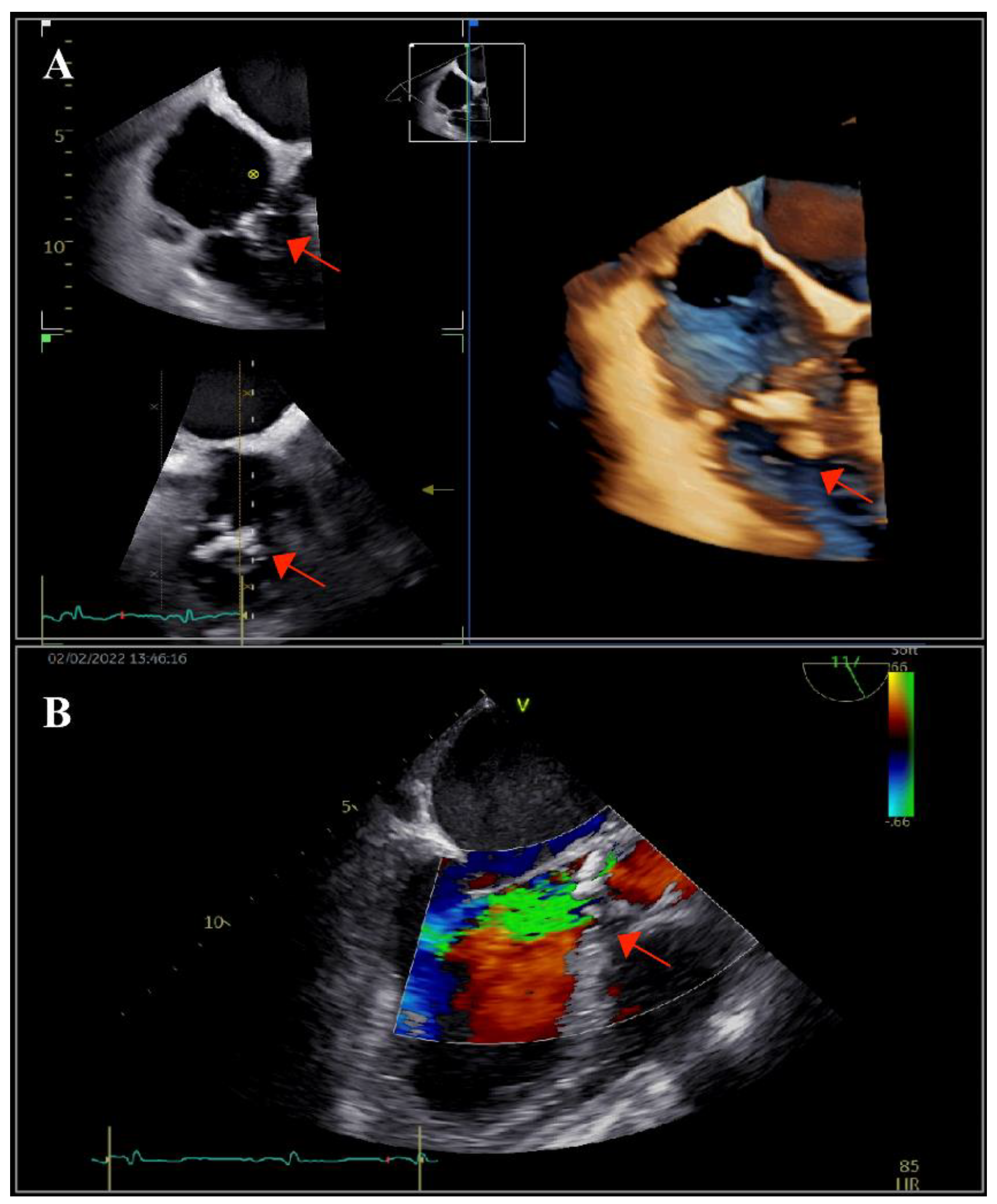 Ijms 23 11127 g001 550