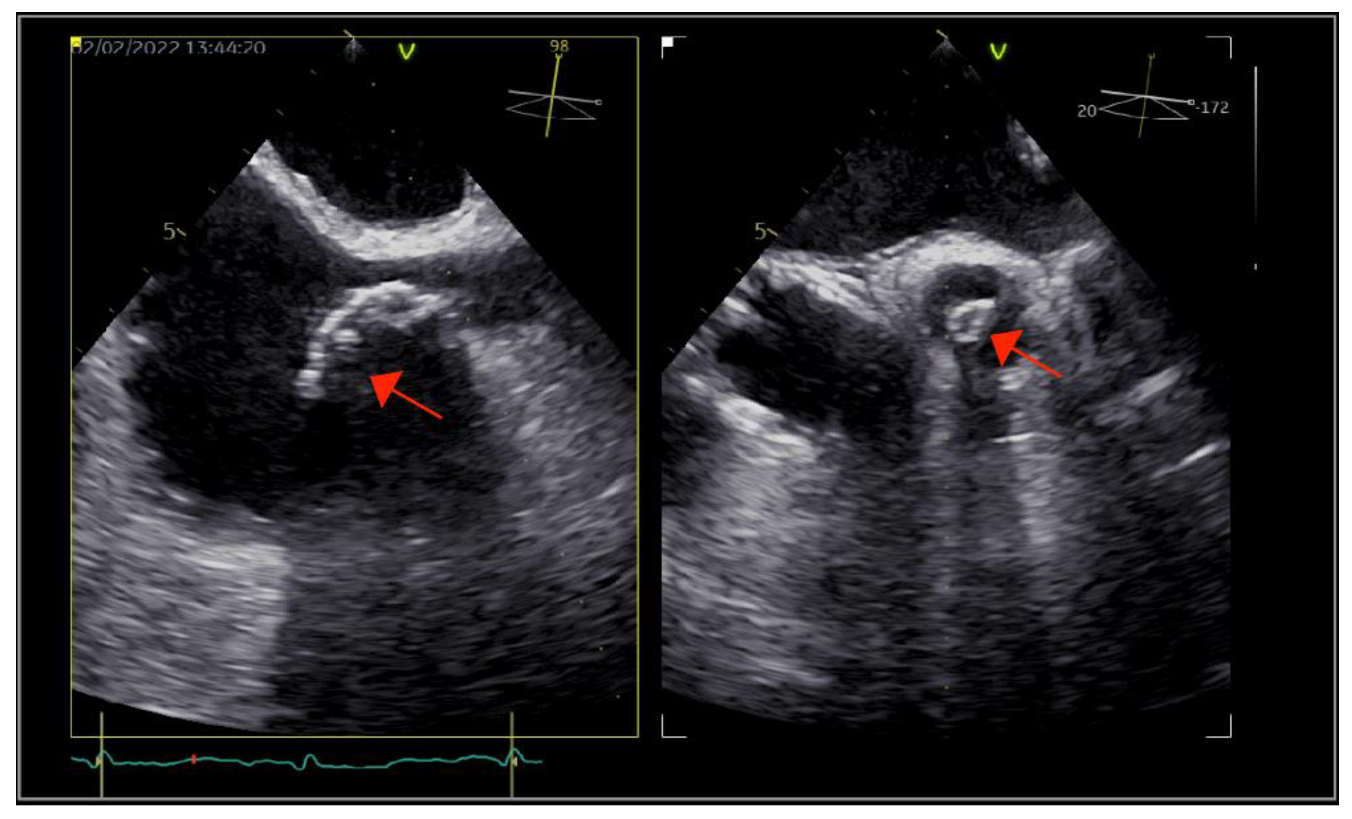 Ijms 23 11127 g002 550