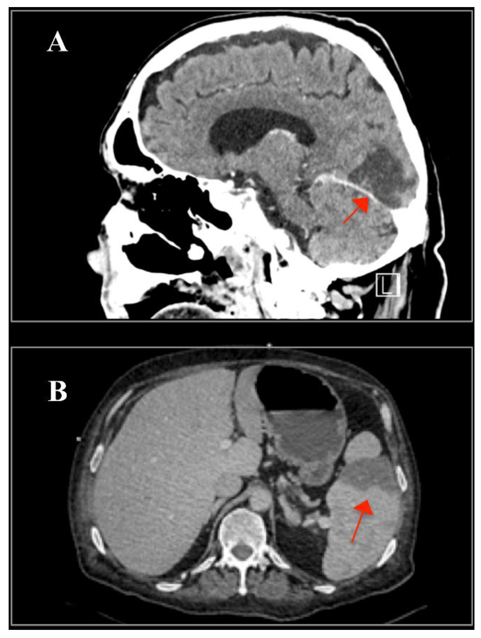 Ijms 23 11127 g004 550