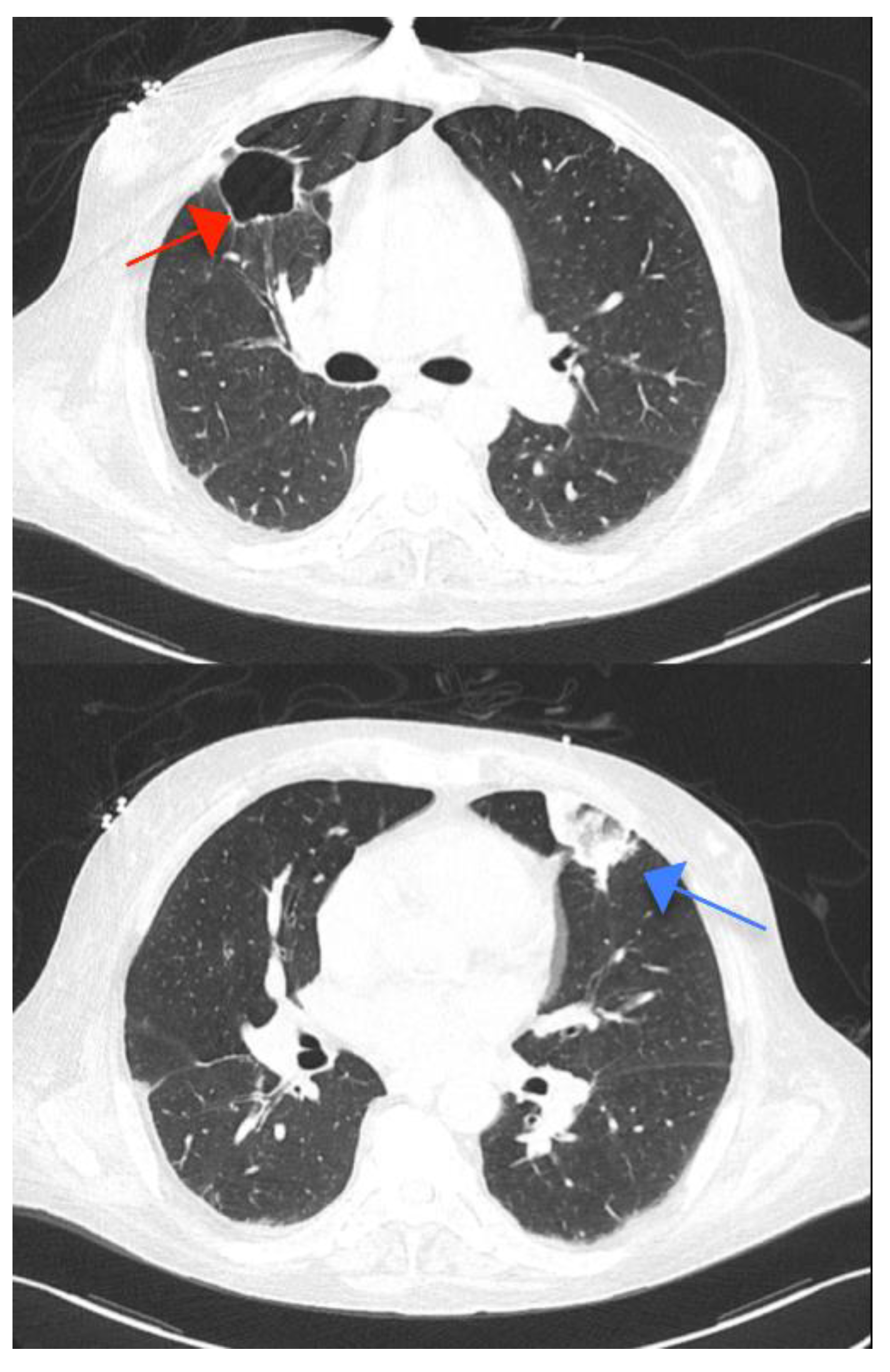 Ijms 23 11127 g005 550