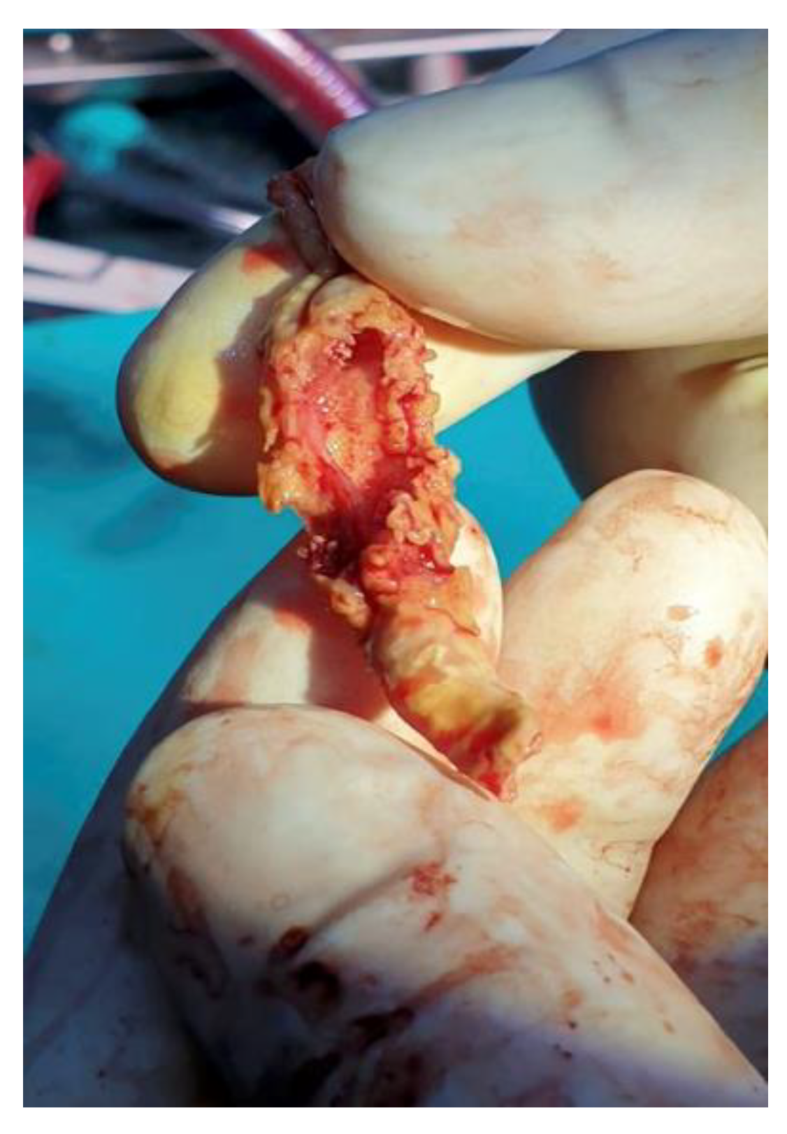 Ijms 23 11127 g006 550