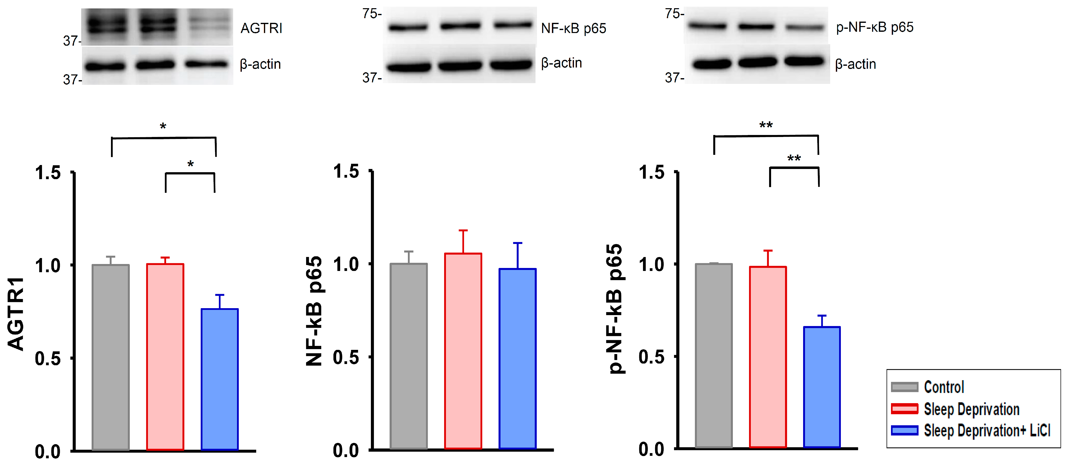 Ijms 23 11226 g004 Ijms 23 11226 g004
