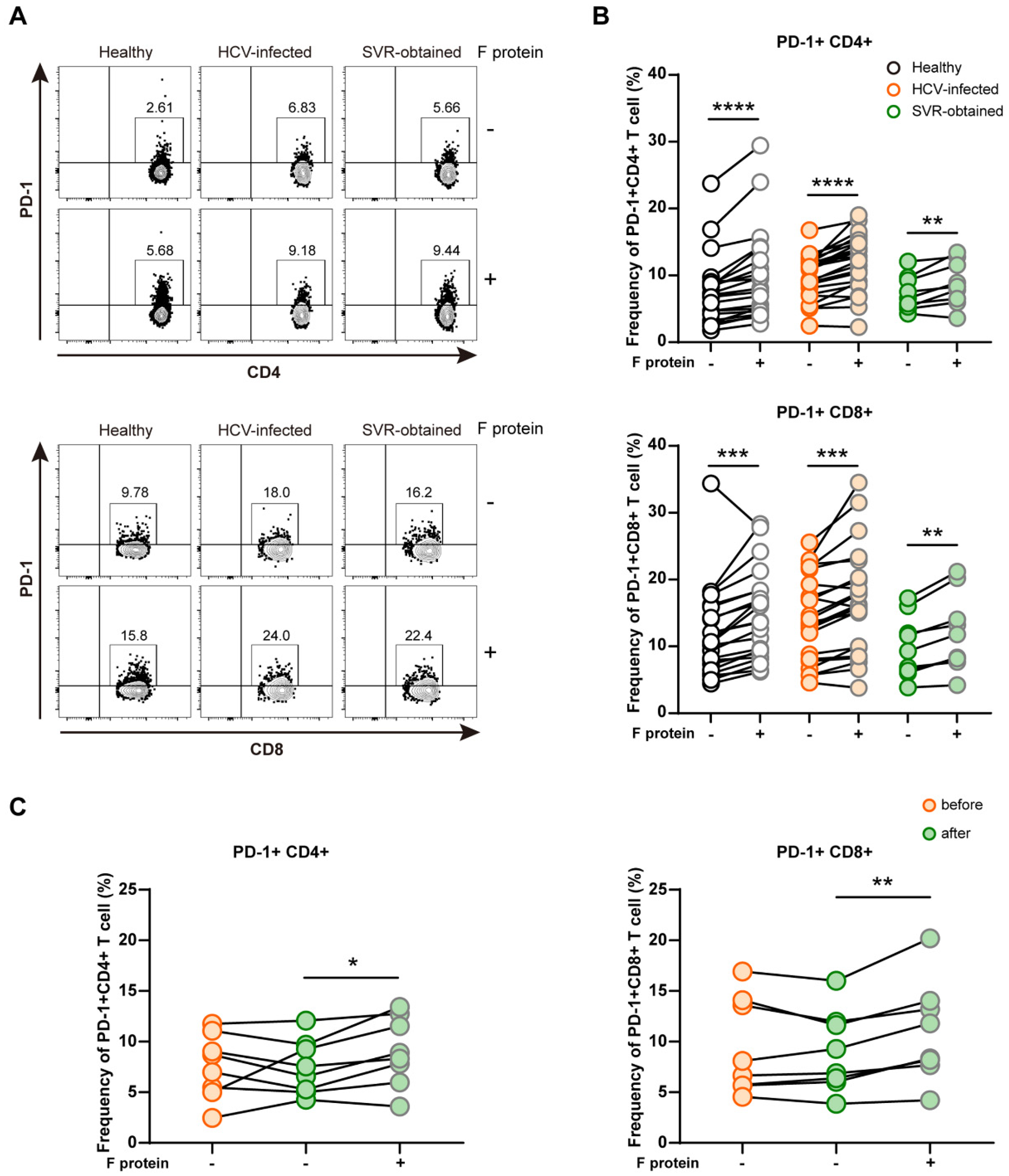 IJMS | Free Full-Text | Alterations in Hepatocellular Carcinoma 