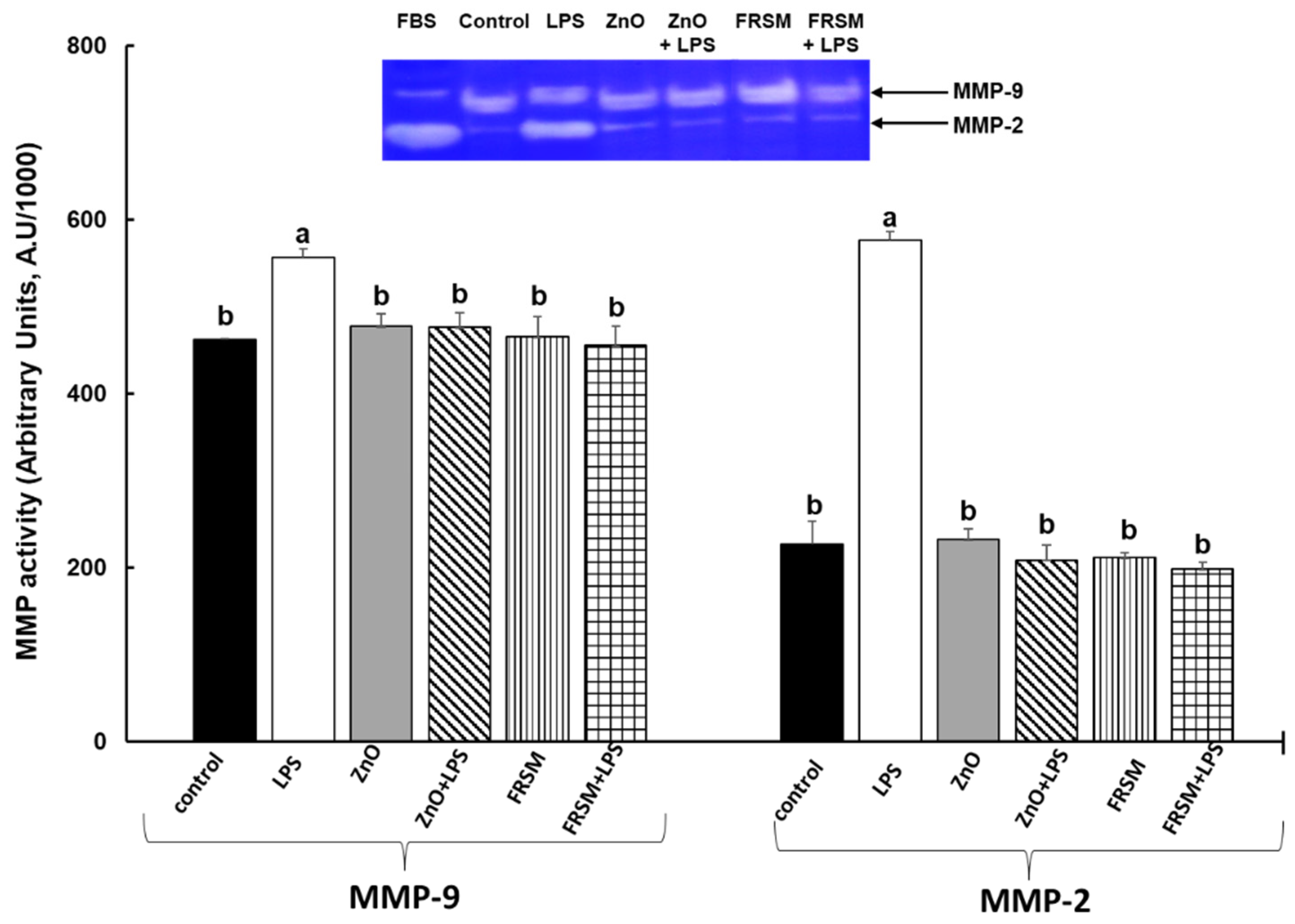 Ijms 23 11640 g005 Ijms 23 11640 g005