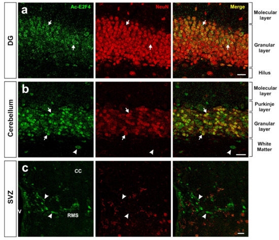 yu-ki E2F4DN Transgenic Mice: A Tool for the Evaluation of E2F4 as