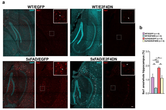 E2F4DN Transgenic Mice: A Tool for the Evaluation of E2F4 as