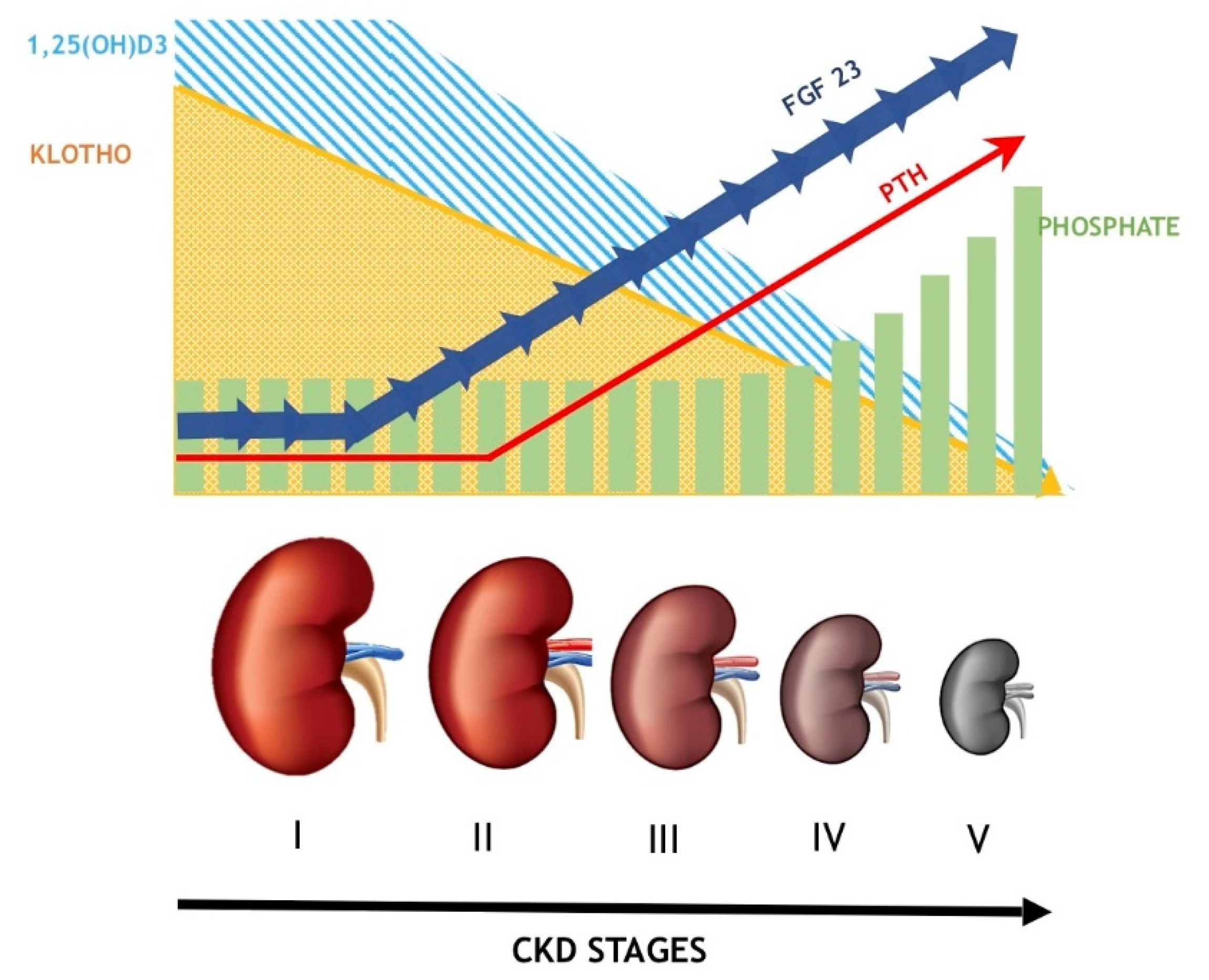 Mineral Bone Disorders in Kidney Disease Patients: The Ever