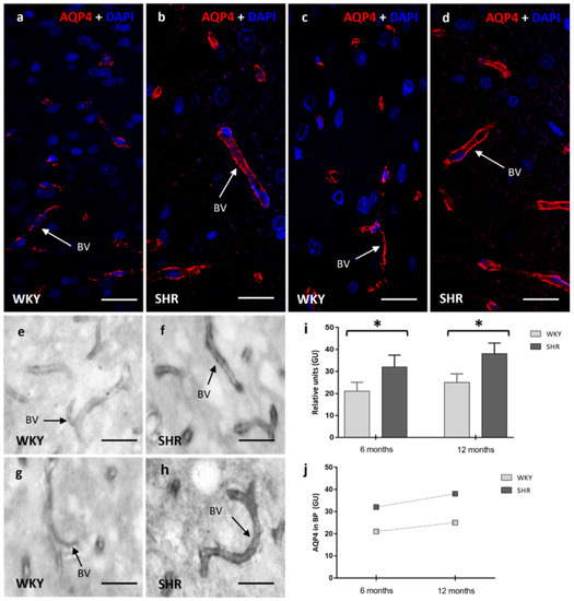 IJMS | Free Full-Text | Altered Expression of AQP1 and AQP4 in Brain ...
