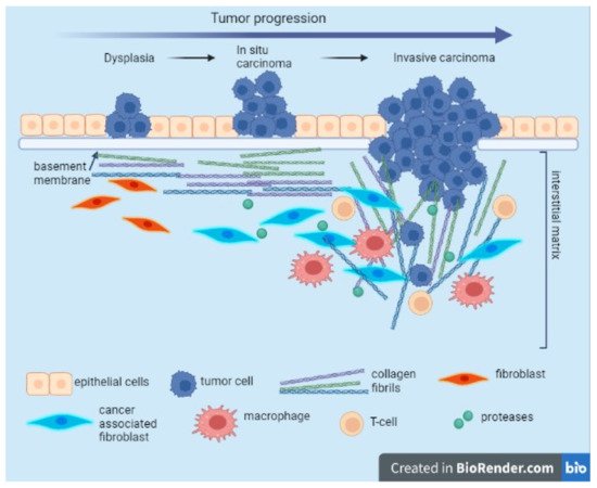 Collagen Family as Promising Biomarkers and Therapeutic Targets in Cancer