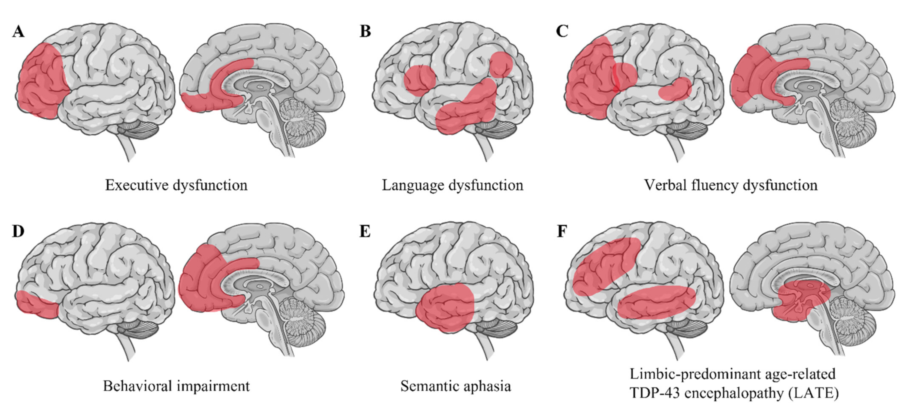 Ijms 23 12508 g003 Ijms 23 12508 g003