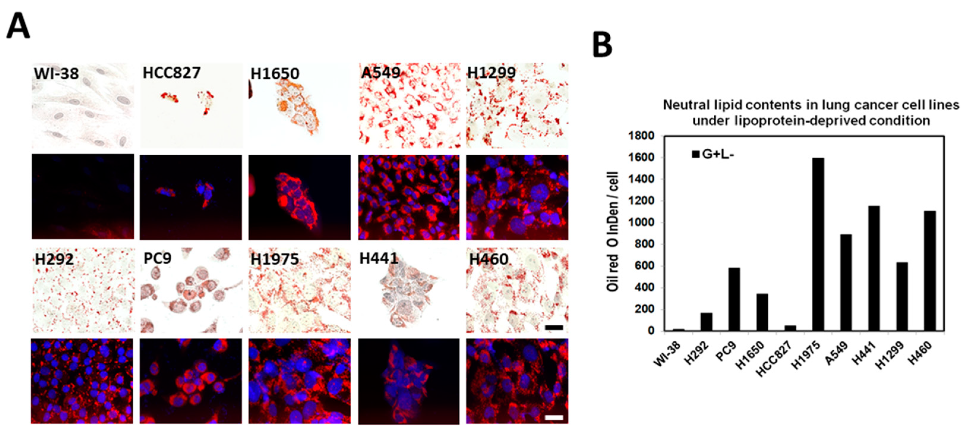 IJMS Free FullText Lipid Droplets in Lung Cancers Are Crucial for