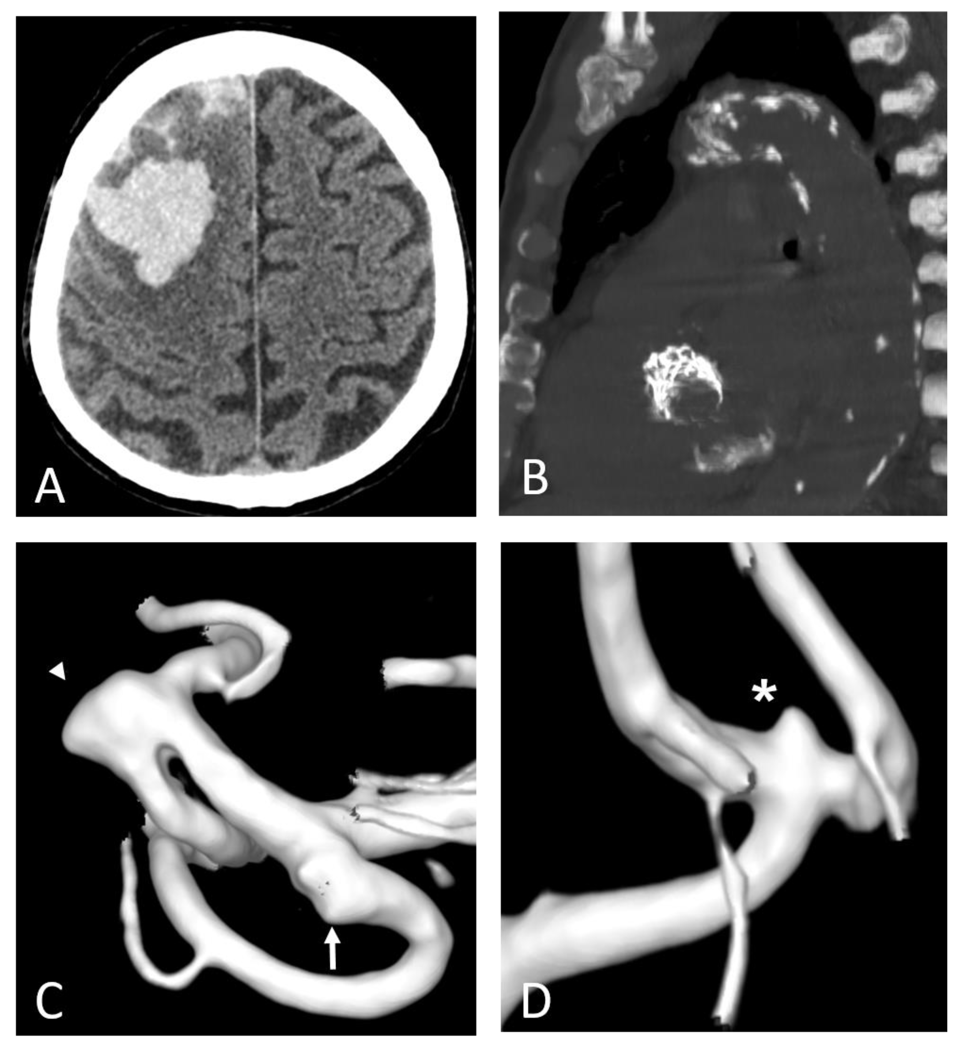Ijms 23 12906 g007 Ijms 23 12906 g007