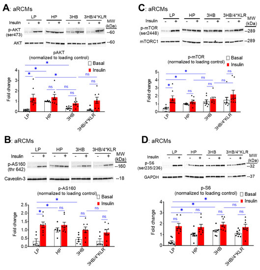 IJMS | Free Full-Text | Ketone Body Exposure of Cardiomyocytes Impairs  Insulin Sensitivity and Contractile Function through Vacuolar-Type  H+-ATPase Disassembly&mdash;Rescue by Specific Amino Acid Supplementation