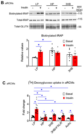 IJMS | Free Full-Text | Ketone Body Exposure of Cardiomyocytes Impairs  Insulin Sensitivity and Contractile Function through Vacuolar-Type  H+-ATPase Disassembly&mdash;Rescue by Specific Amino Acid Supplementation
